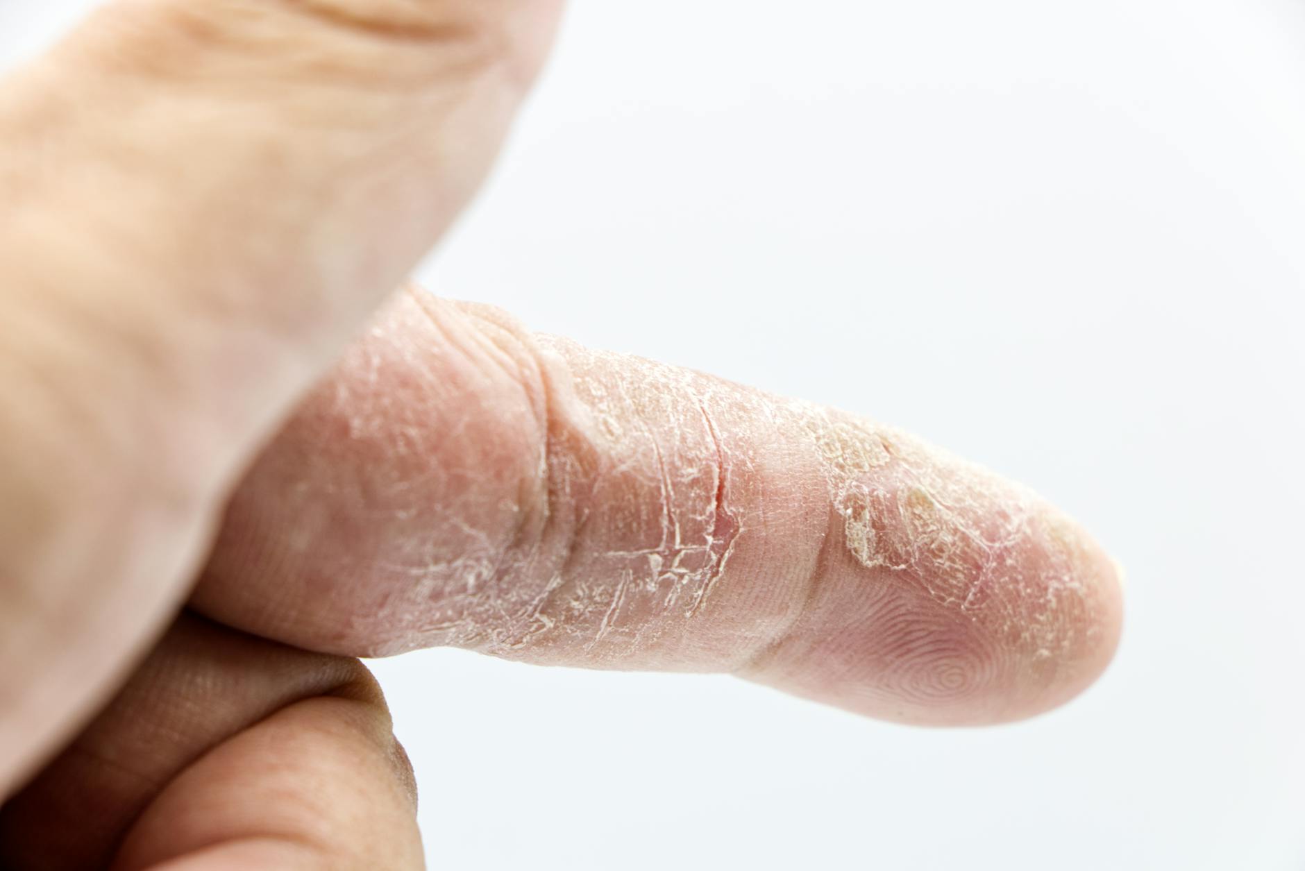 One Man Cracked His Knuckles for 60 Years to Prove Your Parents Wrong
