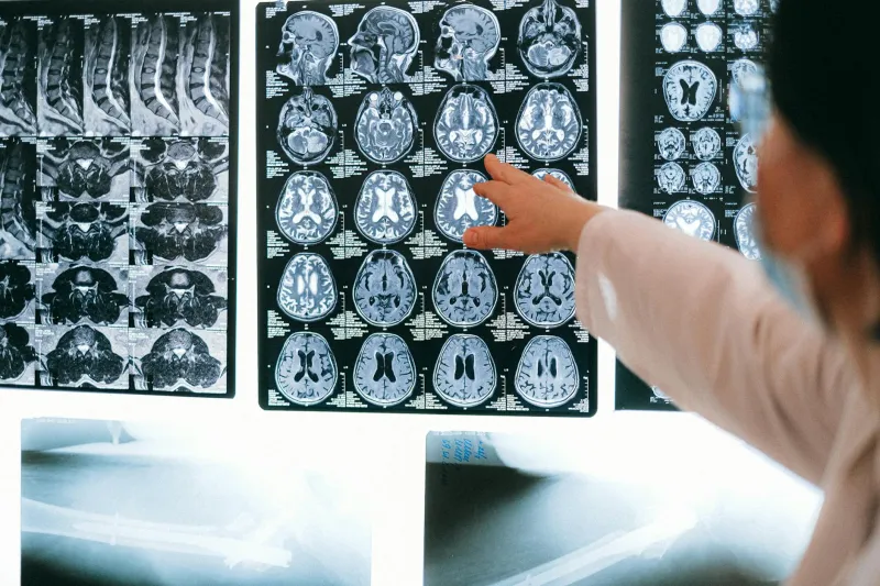 Your Split-Brain Personality Test Results Are Based on Outdated Medical Research, Not Modern Neuroscience